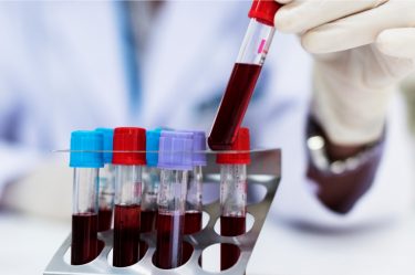 TROMBOFILIA, quais exames fazer, lista completa.