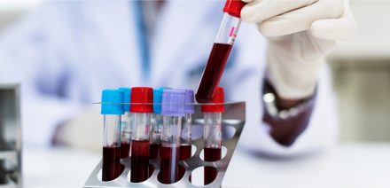 TROMBOFILIA, quais exames fazer?