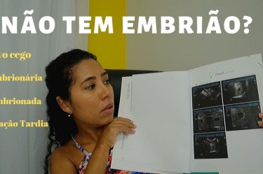 gravidez anembrionada