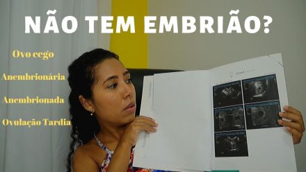 Gravidez anembrionária – Maior susto – Bebê arco-íris
