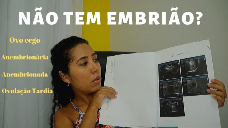 Gravidez anembrionária – Maior susto – Bebê arco-íris
