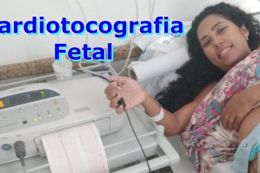 cardiotocografia fetal