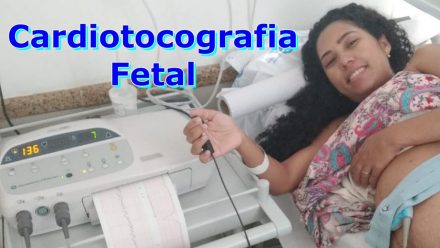 Cardiotocografia Fetal anteparto e intraparto – Tudo que você precisa saber