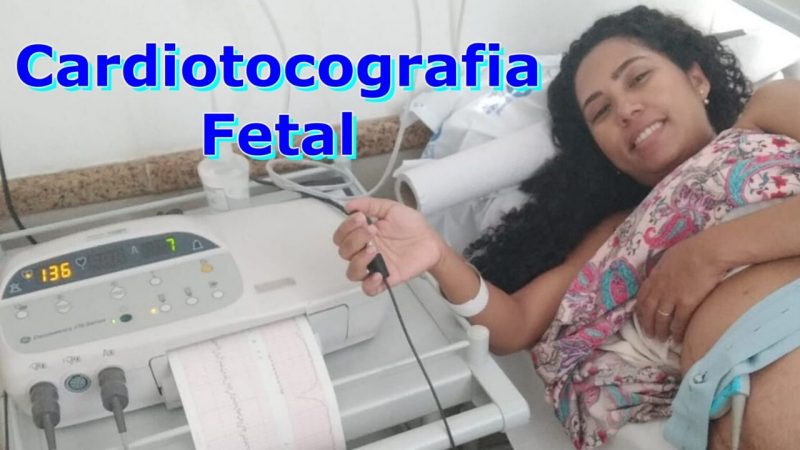 Cardiotocografia Fetal anteparto e intraparto – Tudo que você precisa saber